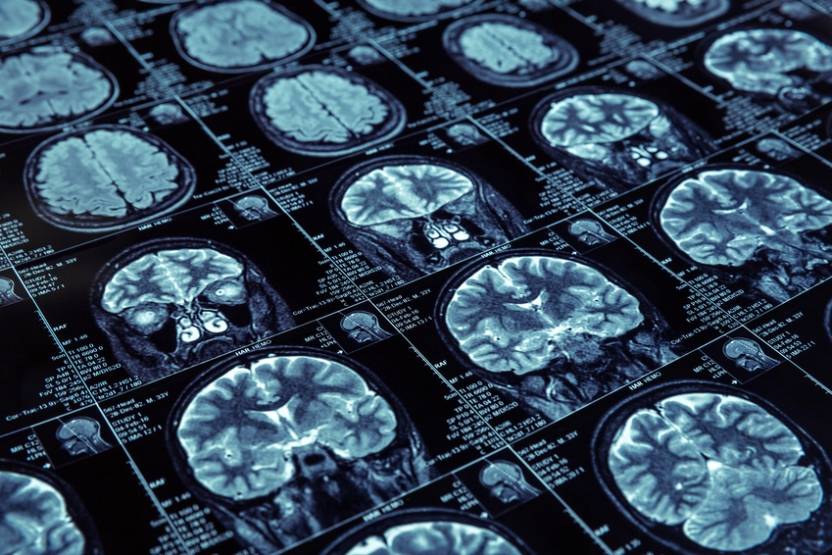 © NeuroNation © NeuroNation