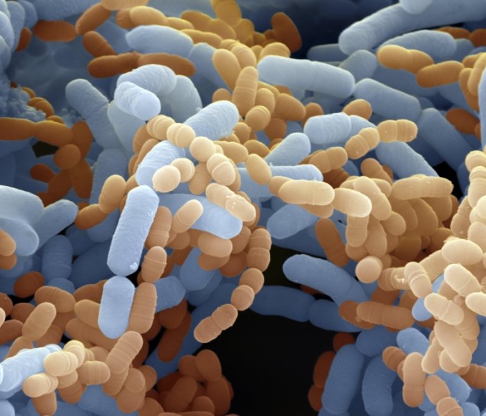 © Eligo Bioscience © Eligo Bioscience