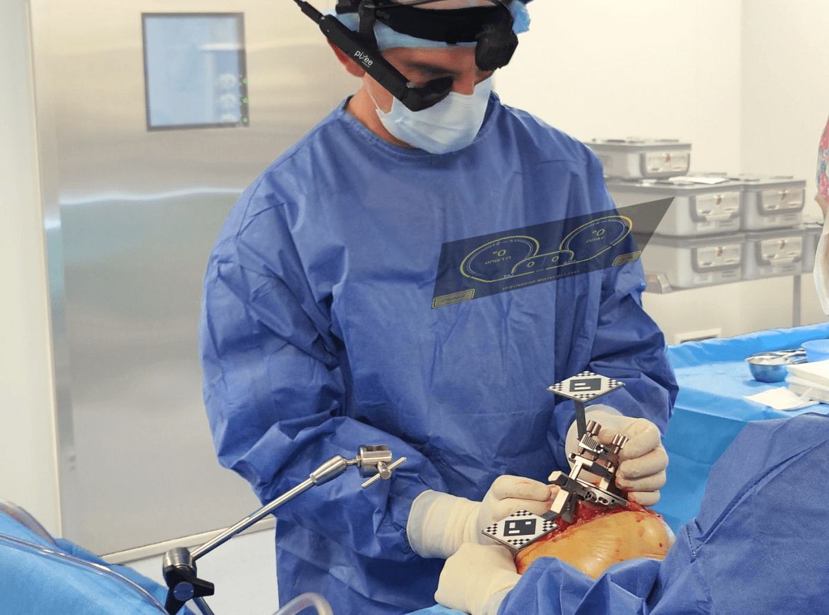 ©Pixee Medical ©Pixee Medical