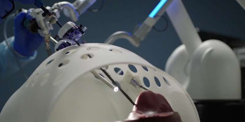 © Moon Surgical © Moon Surgical