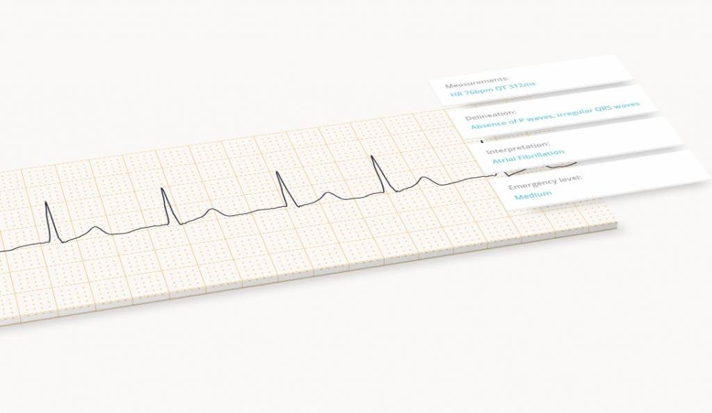 Cardiologs Cardiologs