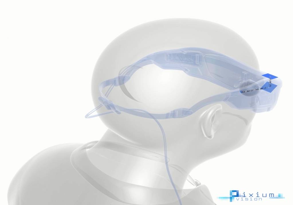 © Pixium Vision © Pixium Vision