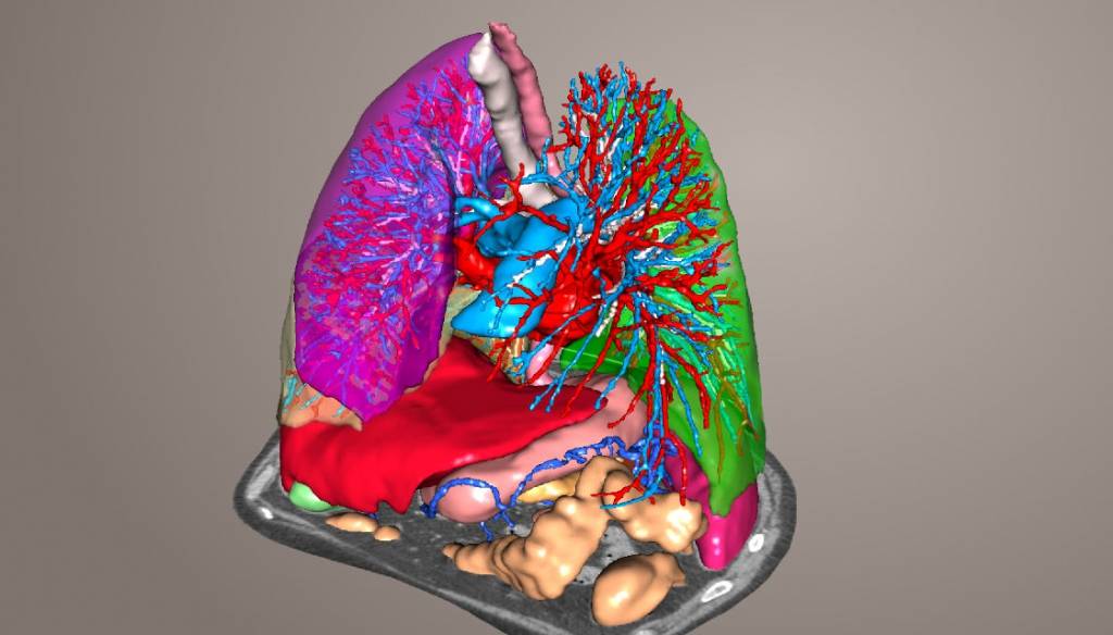 Modélisation 3D de l'anatomie d'un patient Modélisation 3D de l'anatomie d'un patient