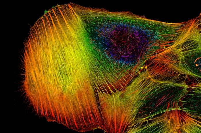 Imagerie moléculaire d'une cellule cancéreuse Imagerie moléculaire d'une cellule cancéreuse