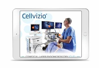 Cellvizio @ Mauna Kea 